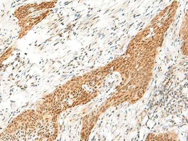 RPS27A Polyclonal Antibody Reactivity Human