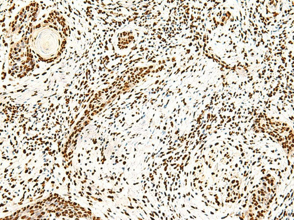 ILF3 Polyclonal Antibody Reactivity Human