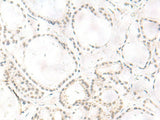 ARL2BP Polyclonal Antibody Reactivity Human