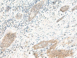 ARL2BP Polyclonal Antibody Reactivity Human