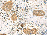 UBD Polyclonal Antibody Reactivity Human