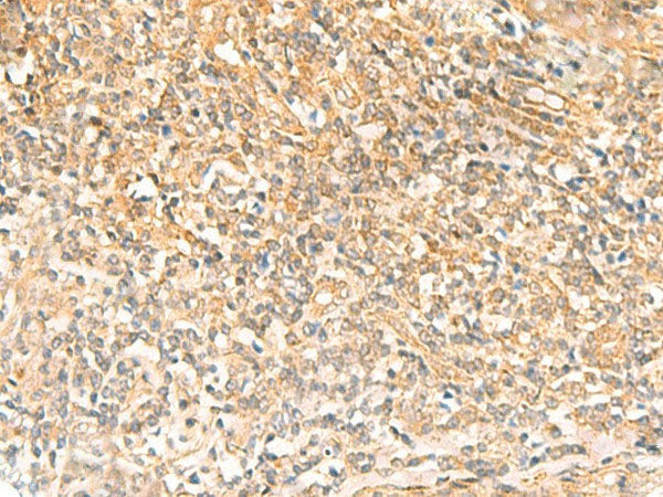 UBD Polyclonal Antibody Reactivity Human