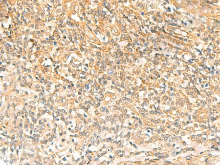 UBD Polyclonal Antibody Reactivity Human