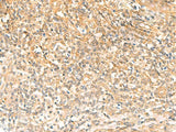 UBD Polyclonal Antibody Reactivity Human