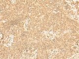 ST8SIA4 Polyclonal Antibody Reactivity Human