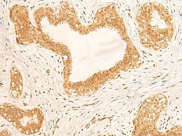ZNF580 Polyclonal Antibody Reactivity Human
