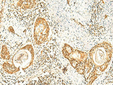 ZNF580 Polyclonal Antibody Reactivity Human