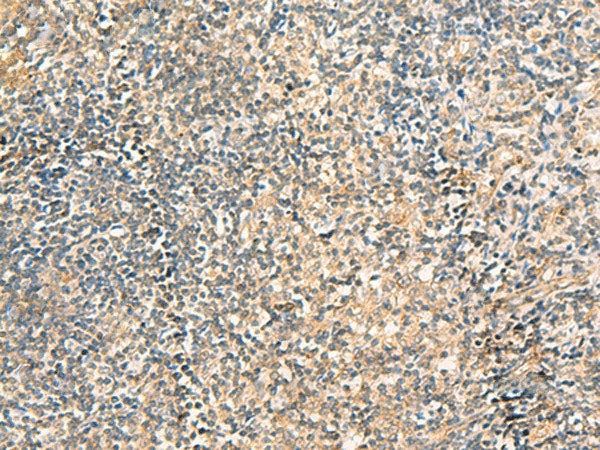 TXNDC12 Polyclonal Antibody Reactivity Human
