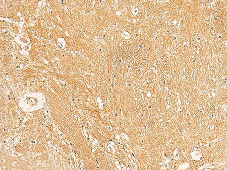 TXNDC12 Polyclonal Antibody Reactivity Human
