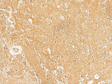 TXNDC12 Polyclonal Antibody Reactivity Human