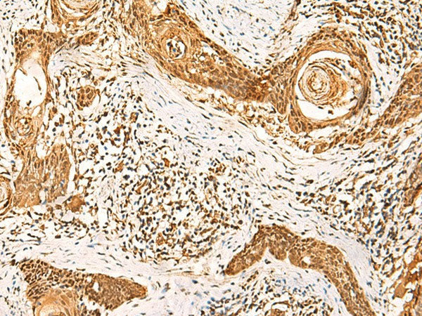 GSG1L Polyclonal Antibody Reactivity Human