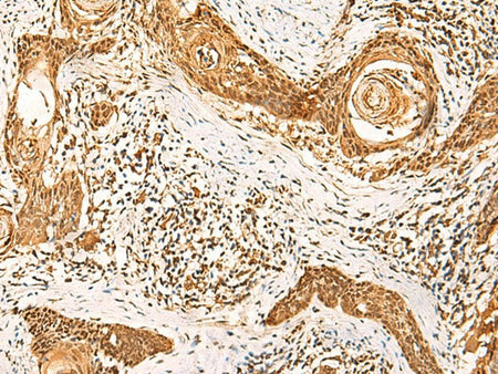 GSG1L Polyclonal Antibody Reactivity Human