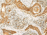 GSG1L Polyclonal Antibody Reactivity Human