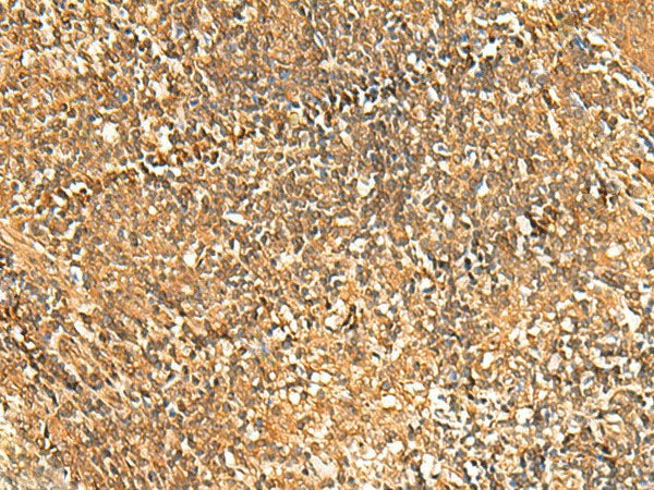 GSG1L Polyclonal Antibody Reactivity Human