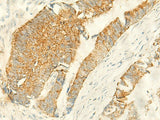 MPV17 Polyclonal Antibody Reactivity Human