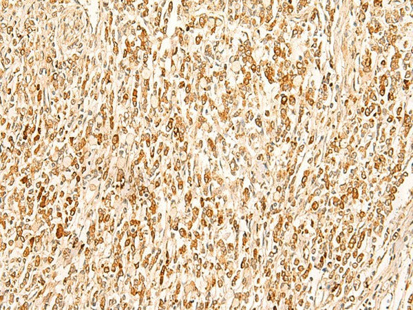 SMUG1 Polyclonal Antibody Reactivity Human