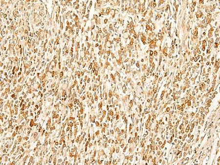 SMUG1 Polyclonal Antibody Reactivity Human