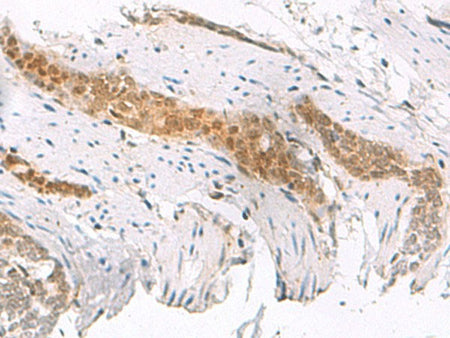 SCAND1 Polyclonal Antibody Reactivity Human