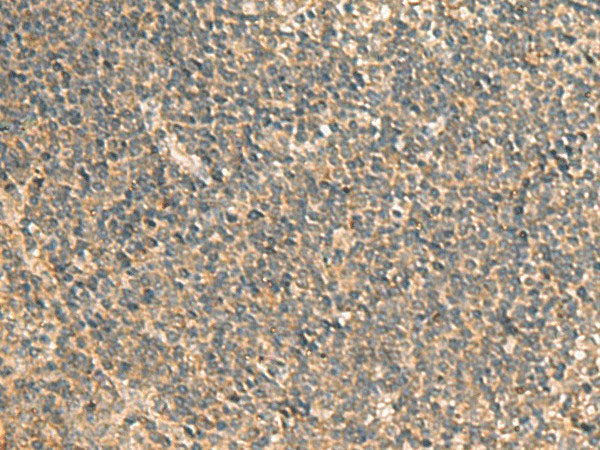 GPBP1 Polyclonal Antibody