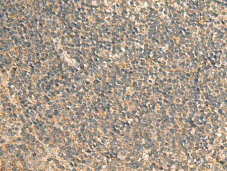 GPBP1 Polyclonal Antibody