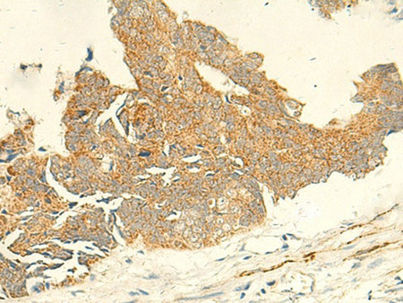 TMEM9 Polyclonal Antibody Reactivity Human