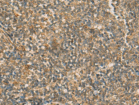 IFT22 Polyclonal Antibody