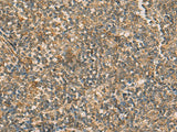 IFT22 Polyclonal Antibody