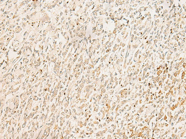GINS2 Polyclonal Antibody