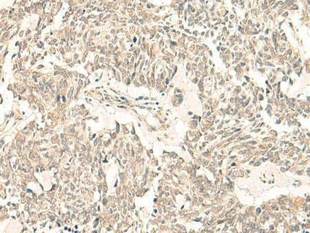 GINS2 Polyclonal Antibody, Biomarkers, Elabscience Biotechnology, MSE Supplies