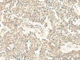 GINS2 Polyclonal Antibody, Biomarkers, Elabscience Biotechnology, MSE Supplies