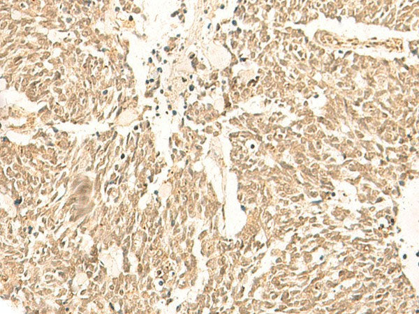 TBPL1 Polyclonal Antibody Reactivity Human
