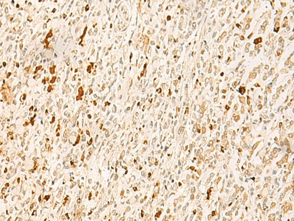 TBPL1 Polyclonal Antibody Reactivity Human