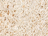 TBPL1 Polyclonal Antibody Reactivity Human