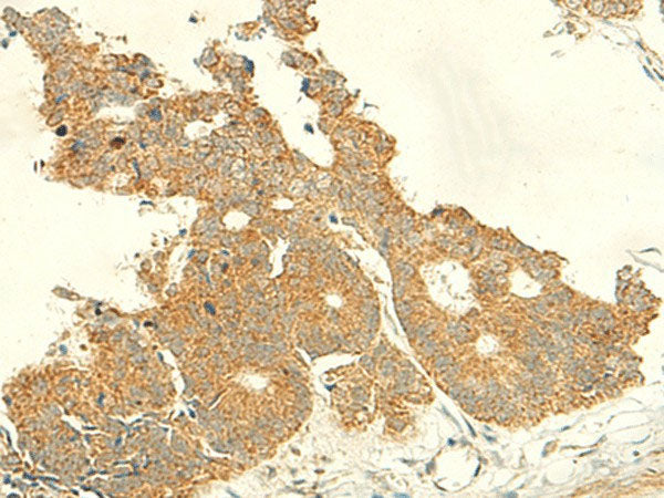 IFT27 Polyclonal Antibody Reactivity Human