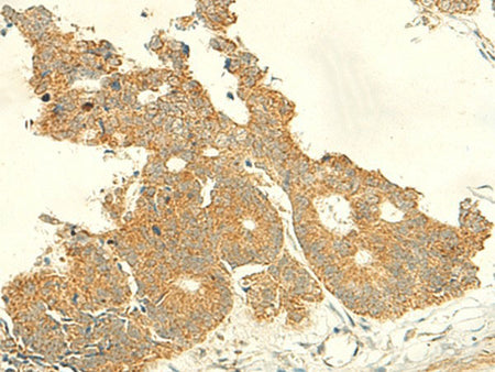 IFT27 Polyclonal Antibody Reactivity Human