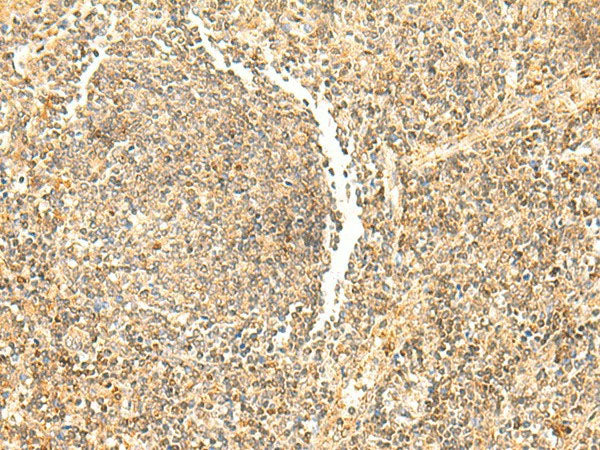 DHFR Polyclonal Antibody Reactivity Human