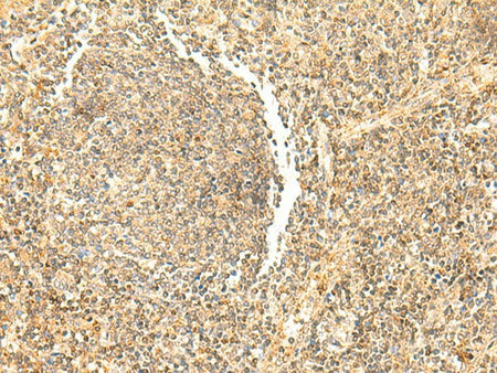 DHFR Polyclonal Antibody Reactivity Human