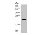 DHFR Polyclonal Antibody Reactivity Human