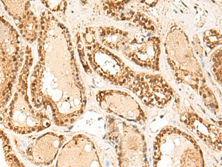 FUNDC2 Polyclonal Antibody Reactivity Human