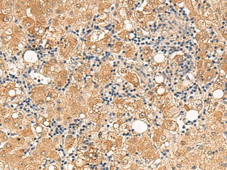 FUNDC2 Polyclonal Antibody Reactivity Human