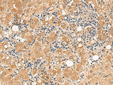 FUNDC2 Polyclonal Antibody Reactivity Human