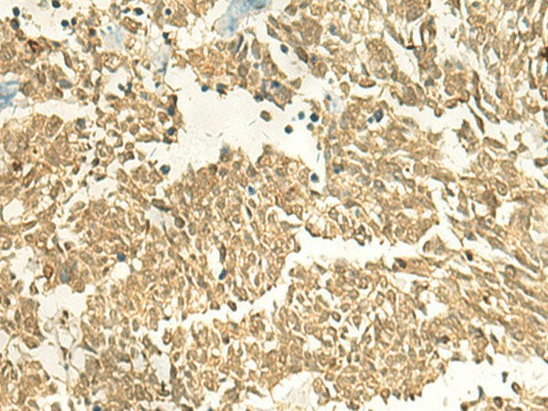 EEF1AKMT2 Polyclonal Antibody Reactivity Human