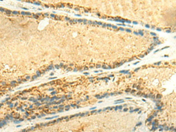 EEF1AKMT2 Polyclonal Antibody Reactivity Human