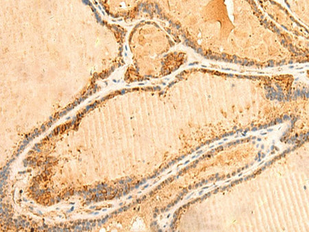 PPM1B Polyclonal Antibody Reactivity Human