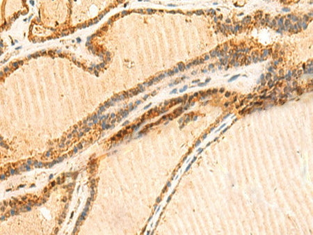 LYZL1 Polyclonal Antibody Reactivity Human