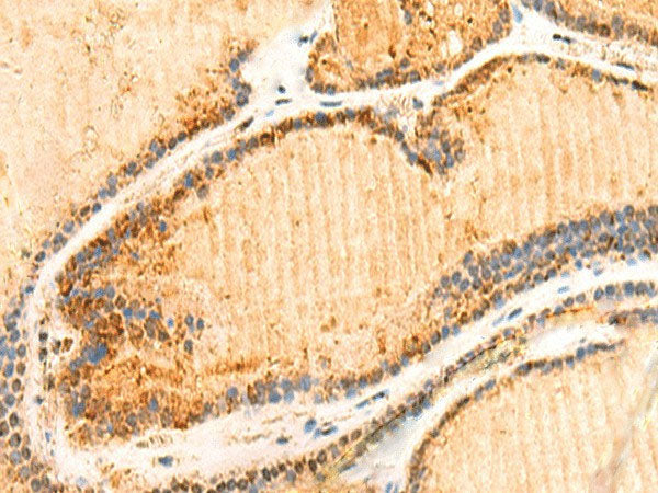 ZNF581 Polyclonal Antibody Reactivity Human