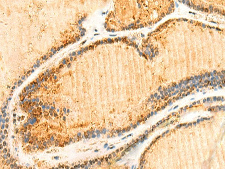 ZNF581 Polyclonal Antibody Reactivity Human
