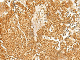 SSSCA1 Polyclonal Antibody Reactivity Human