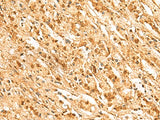 SSSCA1 Polyclonal Antibody Reactivity Human