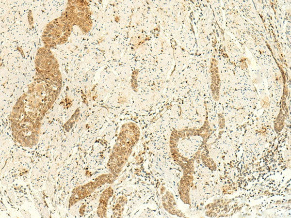 ARL4D Polyclonal Antibody Reactivity Human